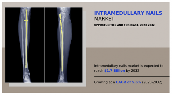 Intramedullary Nails Market - IMG1