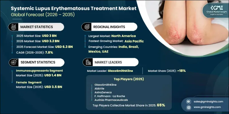 Systemic Lupus Erythematosus Treatment Market - IMG1