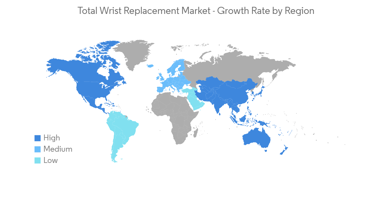 Total Wrist Replacement Market - IMG2