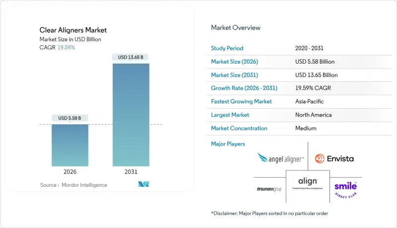 Clear Aligners - Market - IMG1