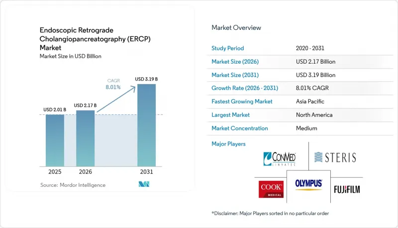 Endoscopic Retrograde Cholangiopancreatography (ERCP) - Market - IMG1