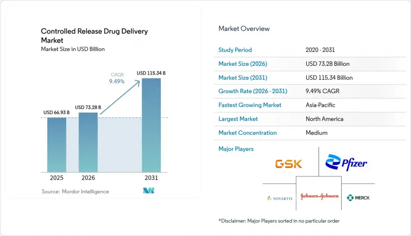 Controlled Release Drug Delivery - Market - IMG1