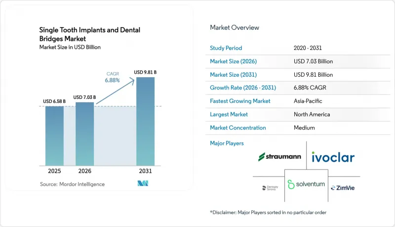 Single Tooth Implants And Dental Bridges - Market - IMG1