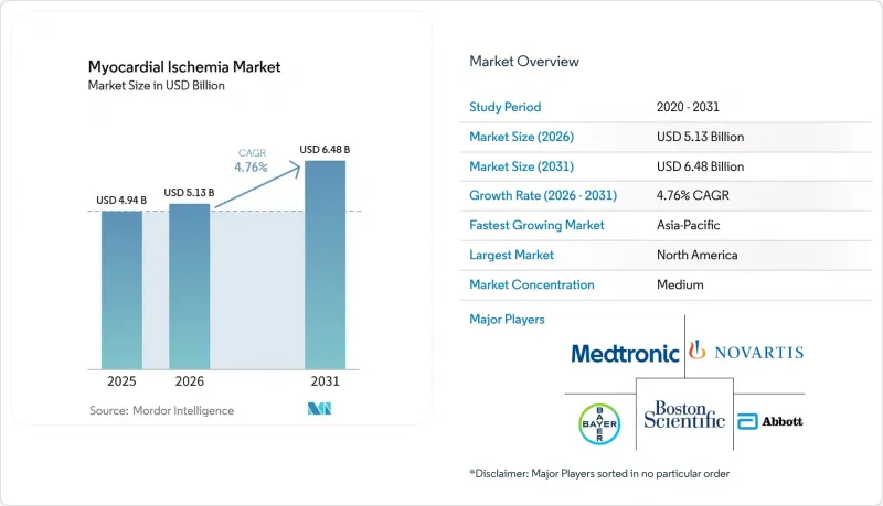Myocardial Ischemia - Market - IMG1