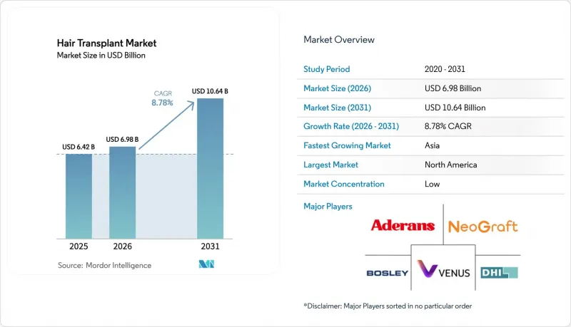 Hair Transplant - Market - IMG1