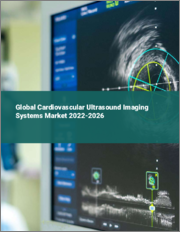Global Cardiovascular Ultrasound Imaging Systems Market 2022-2026