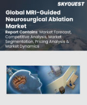 MRI-Guided Neurosurgical Ablation Market Size, Share, and Growth Analysis, By Product (MRI Guided Laser Ablation Systems, MRI Guided RF Ablation Systems), By Indication (Tumors, Epilepsy), By End-Use, By Region - Industry Forecast 2026-2033