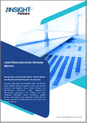 Joint Reconstruction Devices Market Size and Forecast 2021 - 2031, Global and Regional Share, Trend, and Growth Opportunity Analysis Report Coverage: By Type, Technique, End User, and Geography