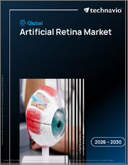 Global Artificial Retina Market 2026-2030