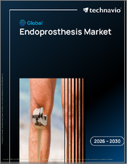 Global Endoprosthesis Market 2026-2030