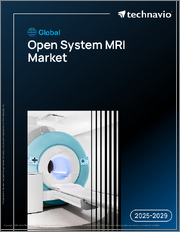 Global Open System Mri Market 2025-2029