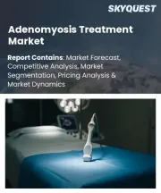 Adenomyosis Treatment Market Size, Share, and Growth Analysis, By Treatment Modality (Pharmacological Therapy, Minimally Invasive Procedures), By Diagnosis Type, By End-User, By Distribution Channel, By Region - Industry Forecast 2026-2033