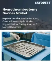 Neurothrombectomy Devices Market Size, Share, and Growth Analysis, By Device Type, By Technique, By Age Group, By Procedure Type, By Application, By End User, By Region - Industry Forecast 2026-2033