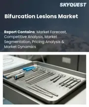 Bifurcation Lesions Market Size, Share, and Growth Analysis, By Product Type, By Lesion Type, By Treatment Technique, By Procedure Type, By End User, By Region - Industry Forecast 2026-2033