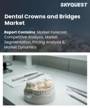 Dental Crowns and Bridges Market Size, Share, and Growth Analysis, By Product Type (Crowns, Bridges), By Material (Ceramic, Zirconia), By Manufacturing Method, By End User, By Region - Industry Forecast 2026-2033