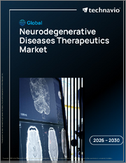 Global Neurodegenerative Diseases Therapeutics Market 2026-2030