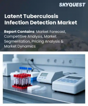 Latent Tuberculosis Infection Detection Market Size, Share, and Growth Analysis, By Test Type (Tuberculin Skin Test (TST), Interferon-Gamma Release Assay (IGRA)), By Application, By End-User Focus, By Region - Industry Forecast 2026-2033