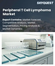 Peripheral T Cell Lymphoma Market Size, Share, and Growth Analysis, By Treatment Type (Chemotherapy (CHOP, CHOEP)), By PTCL Subtype (PTCL-NOS, Angioimmunoblastic T-Cell Lymphoma), By Distribution, By End-User, By Region - Industry Forecast 2026-2033